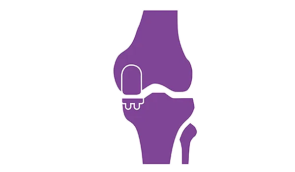 Mako Partial Knee