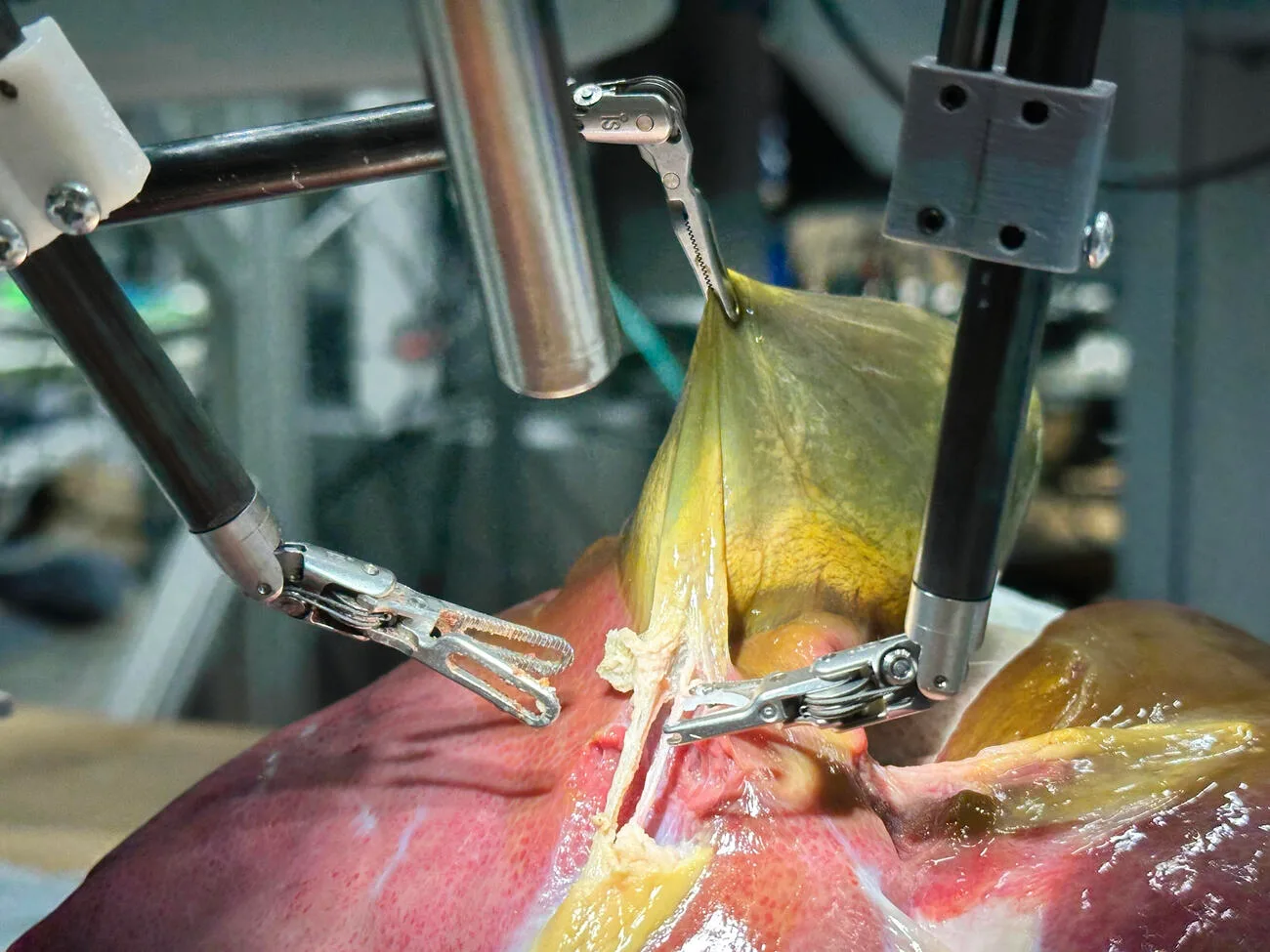 SRT-H (Surgical Robot Transformer-Hierarchy)